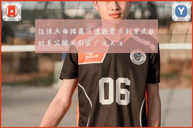 惊悚画面揭露范德彪骨头刺穿皮肤的真实瞬间引发广泛关注